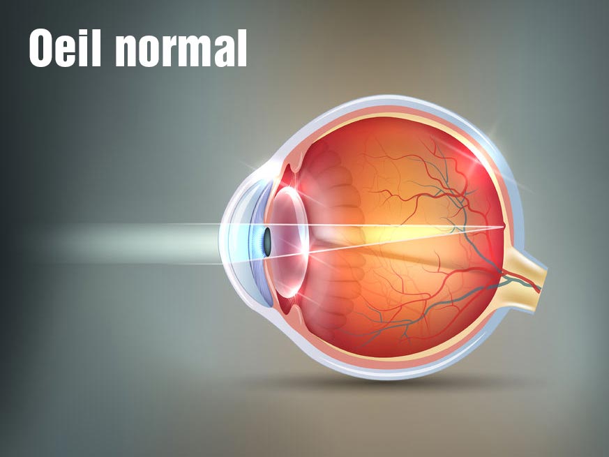 Oeil Normal